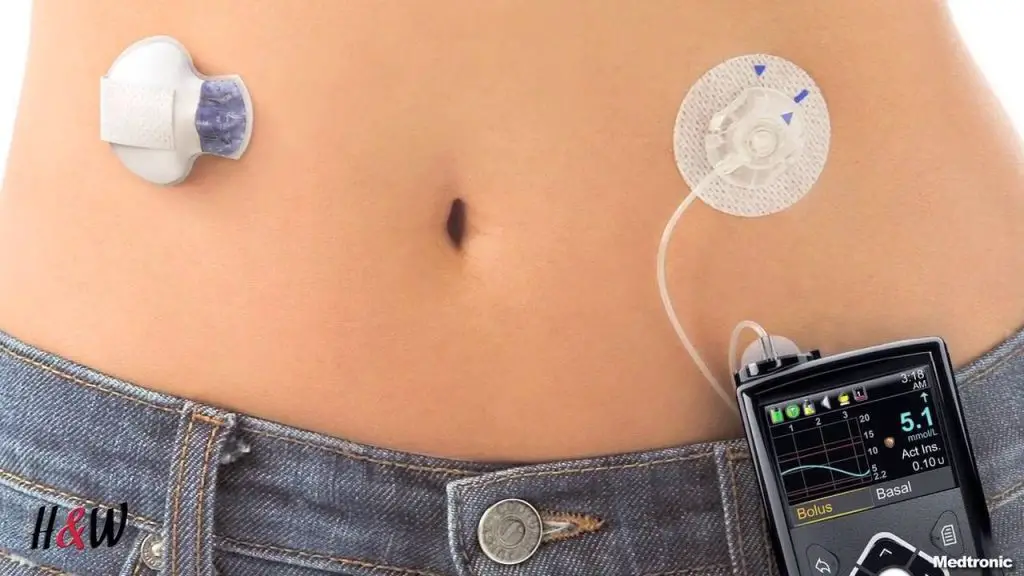 8 Med Tech inventions that will show you how far we have